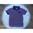 Baker galléros póló felső 4-5 éveseknek